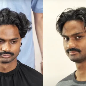 Short layer middle part